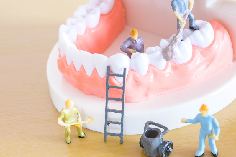 「PMTC」による虫歯・歯周病のリスクコントロール