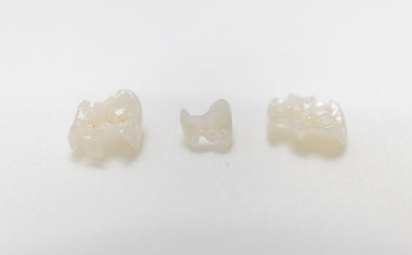 迅速な対応と技工物の精度の向上