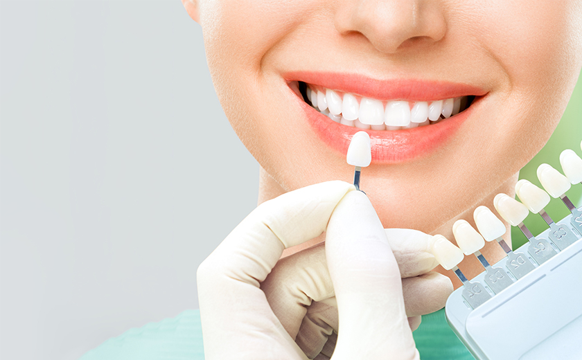 ホワイトニングとは？